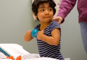 Pediatric patient with limb differences